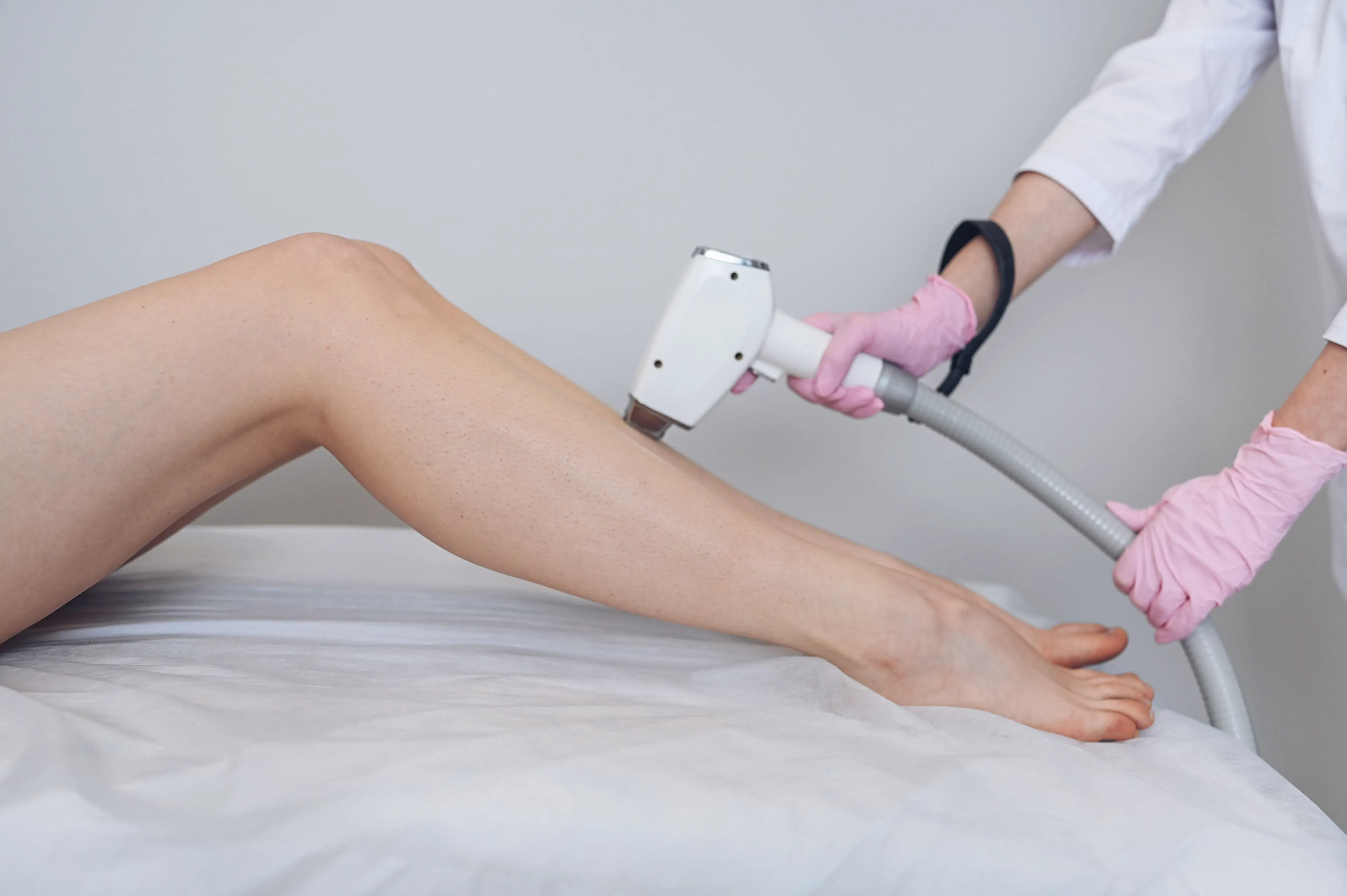 Лазерная эпиляция или электроэпиляция - что выбрать?