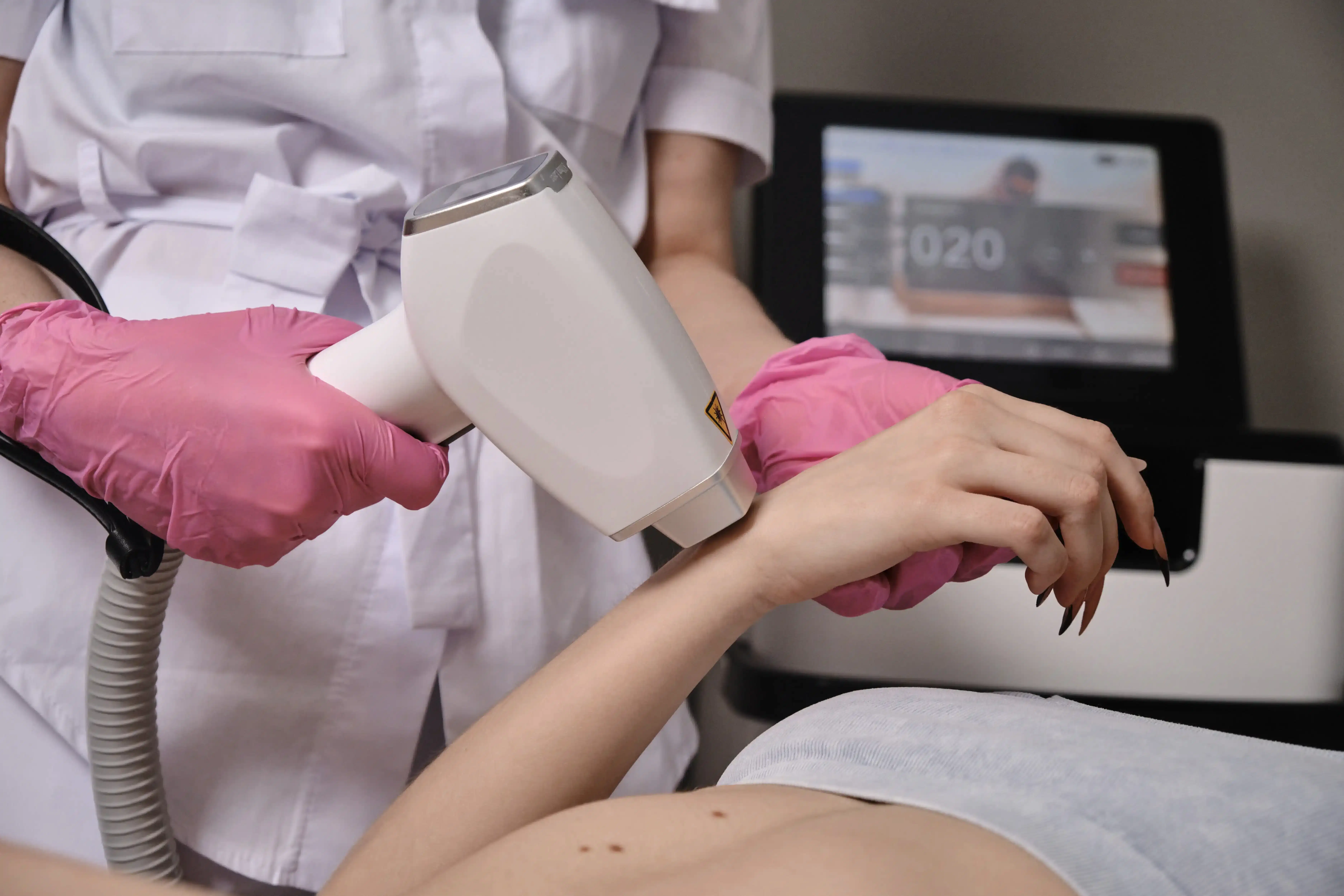 Со скольки лет можно делать лазерную эпиляцию?