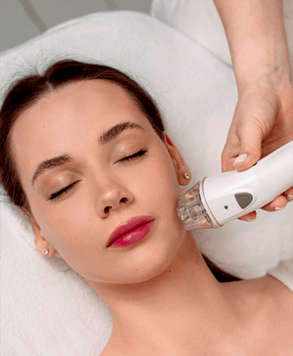 RF-лифтинг лица