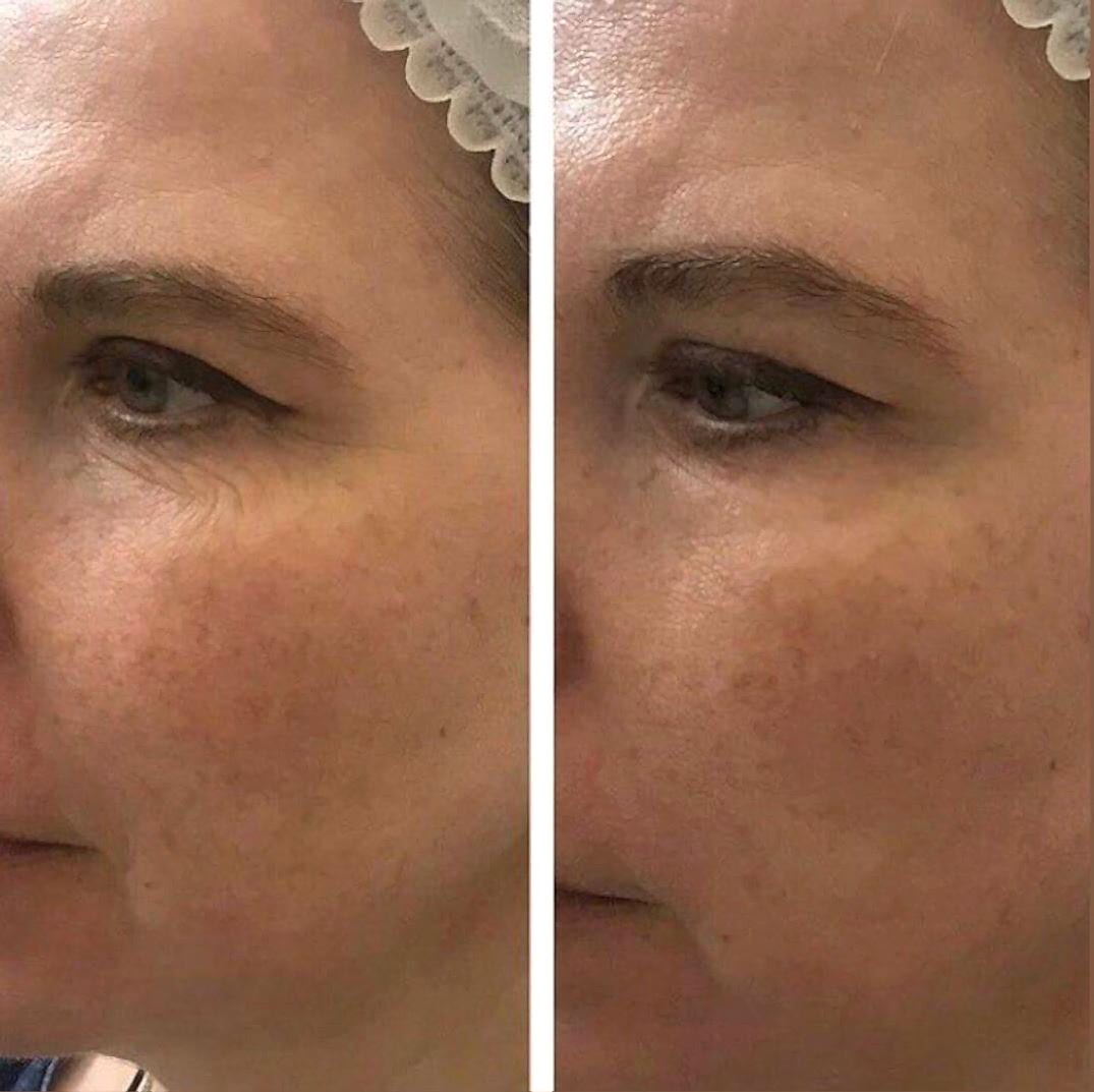 Наши результаты