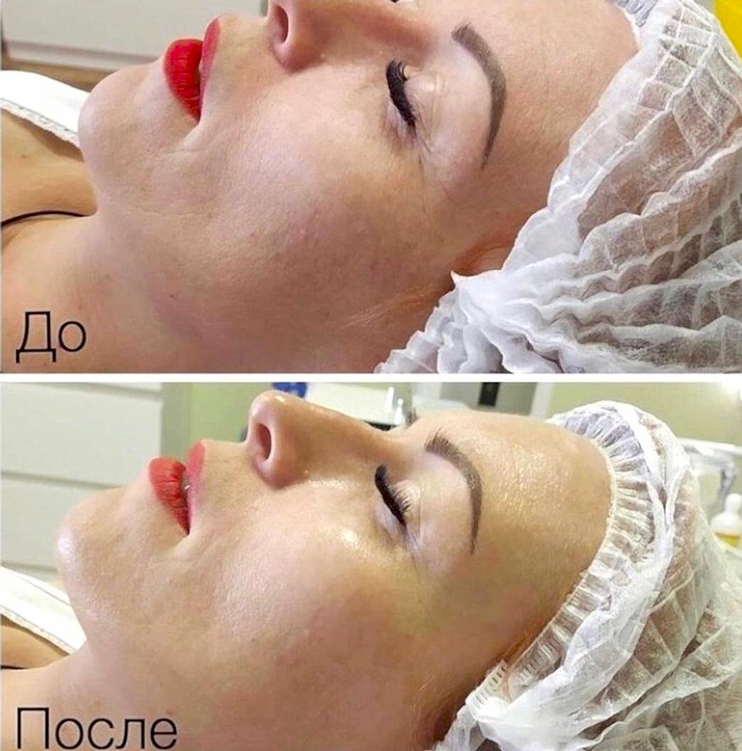 Наши результаты